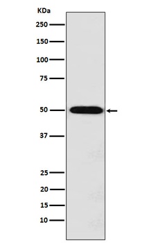 MCT1 Rabbit Monoclonal Antibody