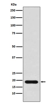 NM23 Rabbit Monoclonal Antibody