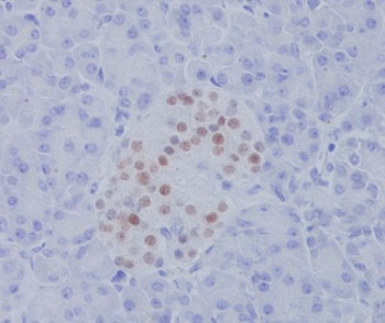 NKX2.2/NKX2 Rabbit Monoclonal Antibody