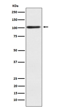 Alpha actinin 2 Rabbit Monoclonal Antibody