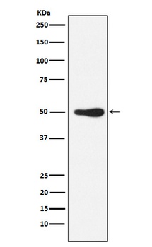 FOXL2 Rabbit Monoclonal Antibody