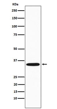GNB2 Rabbit Monoclonal Antibody