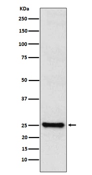 TPPP Rabbit Monoclonal Antibody