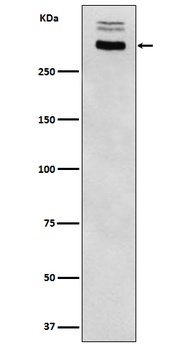 Thyroglobulin Rabbit Monoclonal Antibody