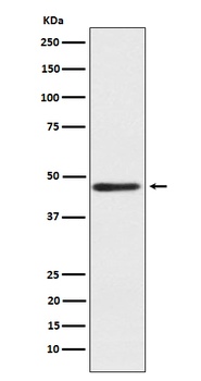 ENTPD5 Rabbit Monoclonal Antibody