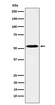 PKA R2 Rabbit Monoclonal Antibody