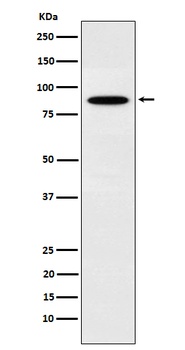 EWSR1 Rabbit Monoclonal Antibody