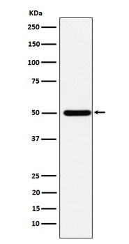 ABAT Rabbit Monoclonal Antibody