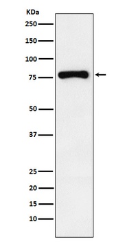 RNase L Rabbit Monoclonal Antibody