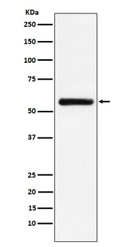 STK33 Rabbit Monoclonal Antibody