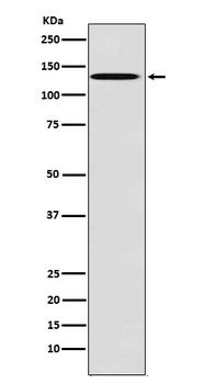TYRO3 Rabbit Monoclonal Antibody