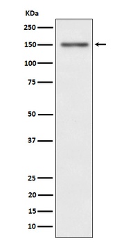 Phospho-Met (c-Met) (Y1349) Rabbit Monoclonal Antibody