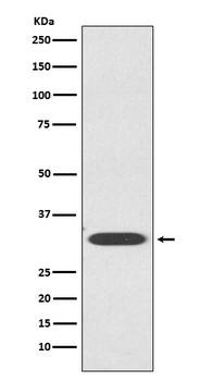 IGFBP1 Rabbit Monoclonal Antibody