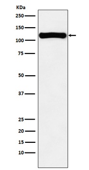 VPS11 Rabbit Monoclonal Antibody