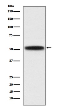 DGAT1 Rabbit Monoclonal Antibody