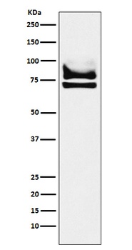 DDX17 Rabbit Monoclonal Antibody