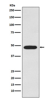 Galactosidase alpha Rabbit Monoclonal Antibody