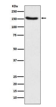 Hamartin Rabbit Monoclonal Antibody
