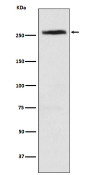 CAD Rabbit Monoclonal Antibody