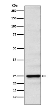 Neurogenin 2 Rabbit Monoclonal Antibody