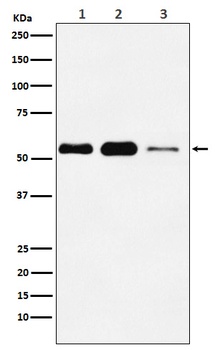 ATGL / PNPLA2 Rabbit Monoclonal Antibody