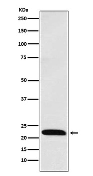 ICOS Rabbit Monoclonal Antibody