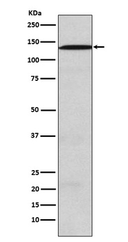 USP28 Rabbit Monoclonal Antibody