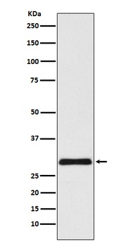 VPS24 Rabbit Monoclonal Antibody