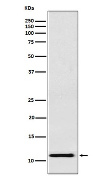 fetal hemoglobin Rabbit Monoclonal Antibody