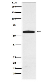 RAD23A Rabbit Monoclonal Antibody