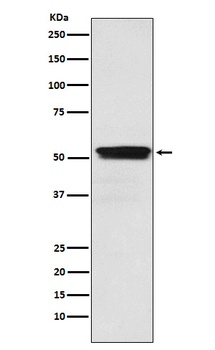 ACM2 Rabbit Monoclonal Antibody