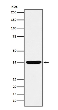 AKR1C1 / AKR1C2 Rabbit Monoclonal Antibody