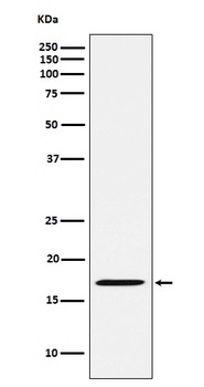 FHIT Rabbit Monoclonal Antibody