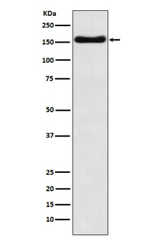 ATP7b Rabbit Monoclonal Antibody