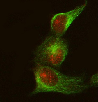 CRKII Rabbit Monoclonal Antibody