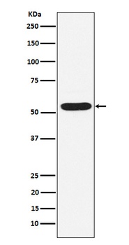 PIAS2 Rabbit Monoclonal Antibody