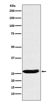 CLPP Rabbit Monoclonal Antibody