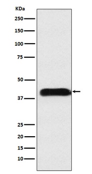 M6PR Rabbit Monoclonal Antibody