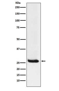 Hippocalcin Rabbit Monoclonal Antibody