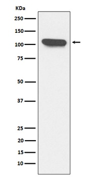 ERAP1 Rabbit Monoclonal Antibody