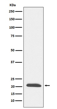 DCTN3 Rabbit Monoclonal Antibody