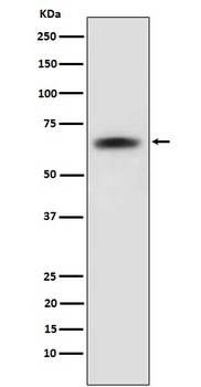 SENP2 Rabbit Monoclonal Antibody
