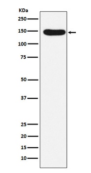 Desmoglein 3 Rabbit Monoclonal Antibody