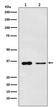 PDLIM1 Rabbit Monoclonal Antibody