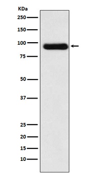 ACVR2A Rabbit Monoclonal Antibody