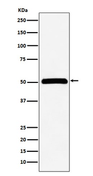 CELF1 Rabbit Monoclonal Antibody