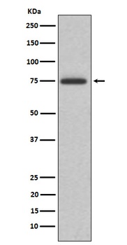 ABI2 Rabbit Monoclonal Antibody