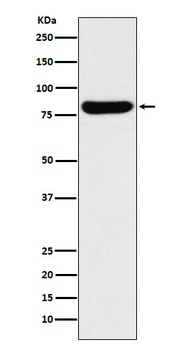 GUSB Rabbit Monoclonal Antibody