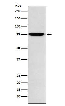 GAA Rabbit Monoclonal Antibody