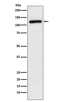APLP2 Rabbit Monoclonal Antibody